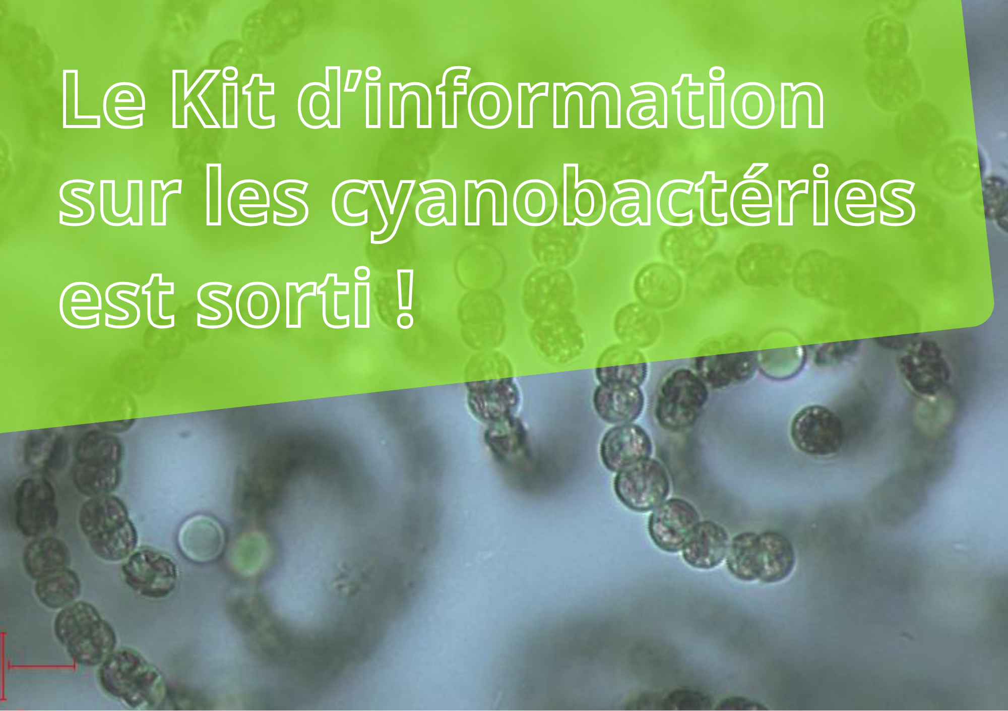 Vignette kit cyano_Edenn